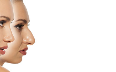 The best rhinoplasty surgeon Melbourne has