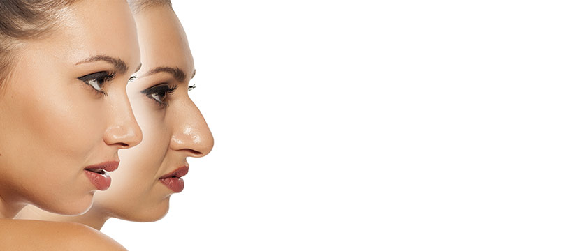 The best rhinoplasty surgeon Melbourne has