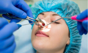 surgical treatment